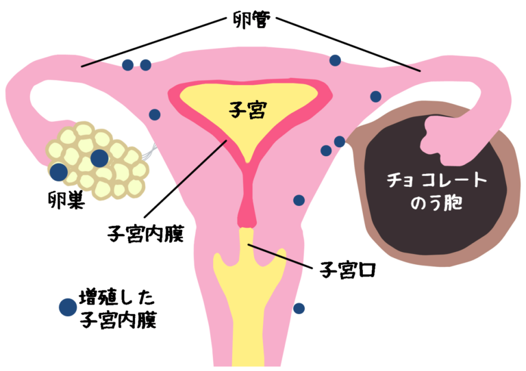 子宮